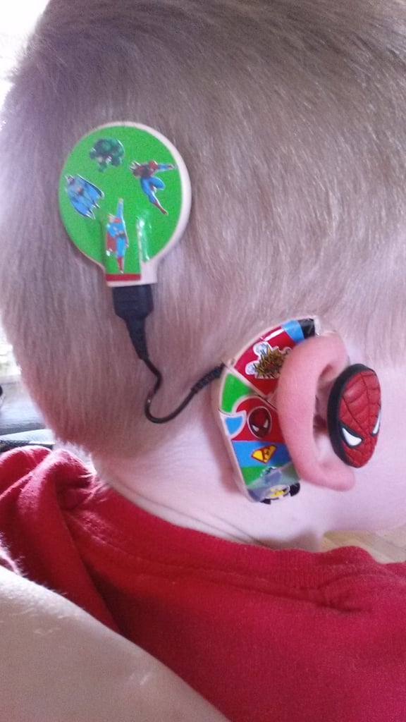 Mom Creates Superhero Hearing Aids For Son