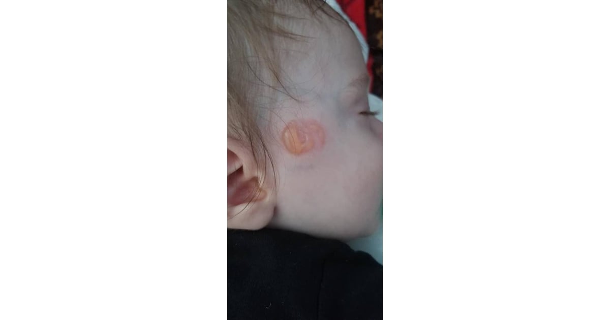 Mom's Warning on Pacifiers After Son Gets Burned POPSUGAR UK