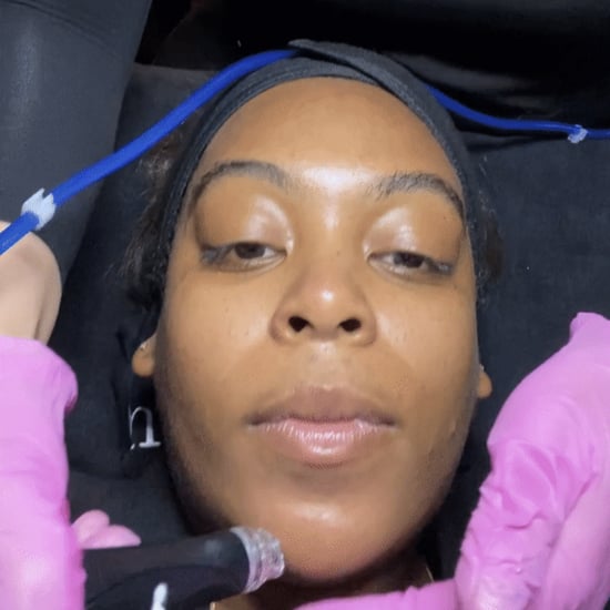 I Tried the "JLo Glow" Hydrafacial