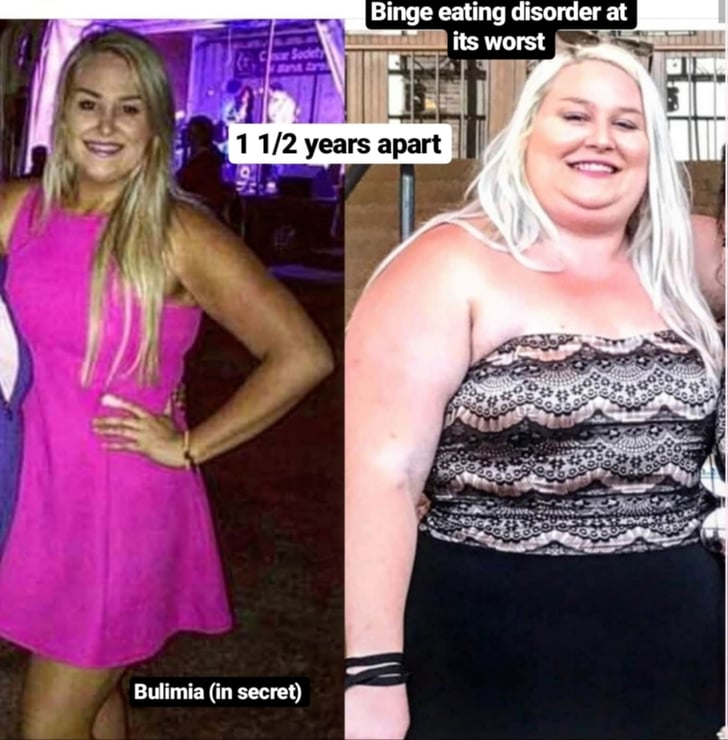Claire's History With Weight and Bullying WeightLoss Transformation