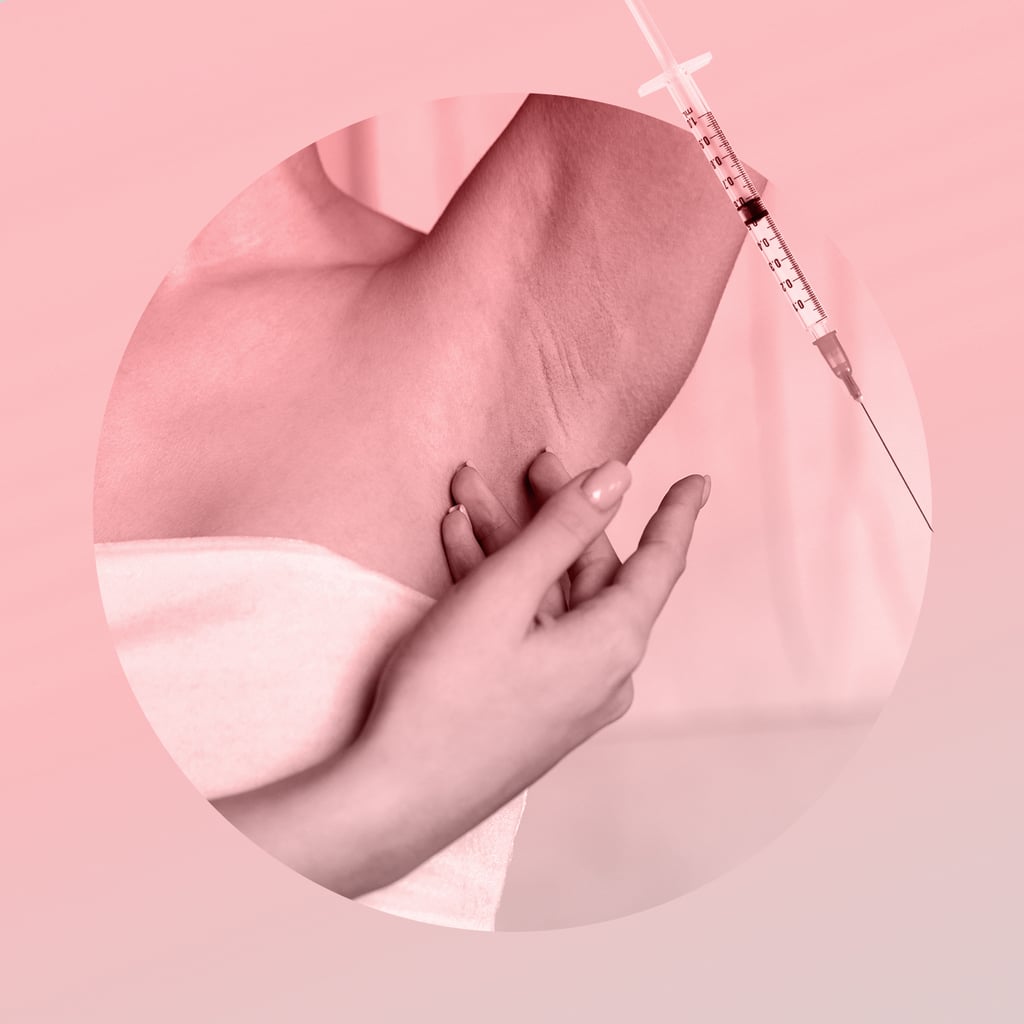 She Dealt With Extremely Sweaty Armpits Her Entire Life — Then She Tried Botox