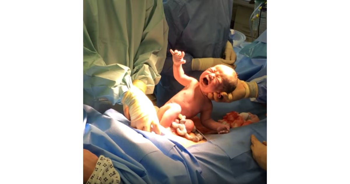 Baby Delivers Itself Via Natural C-Section Procedure | POPSUGAR Family Baby Delivers Itself Via Natural C-Section Procedure | POPSUGAR Family