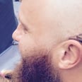 Dad Gets a Tattoo of a Cochlear Implant on His Head to Support His Deaf Daughter