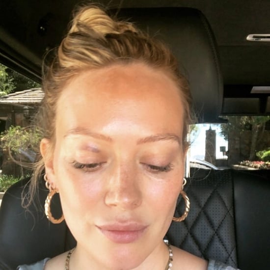 Hilary Duff's Son Accidentally Gave Her a Black Eye