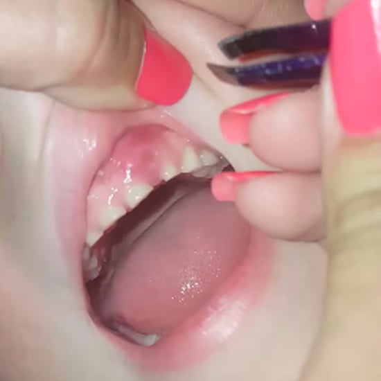 Video of Mom Pulling Fingernails Out of Boy's Gums