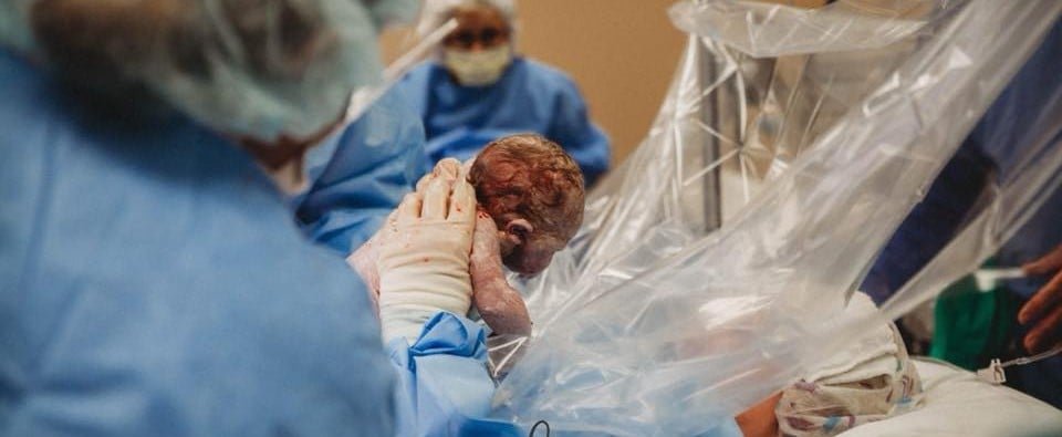 Midwife Delivers Own Baby Via C-Section