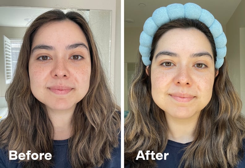 Before and After Using the Versed Skin Hydration Trio