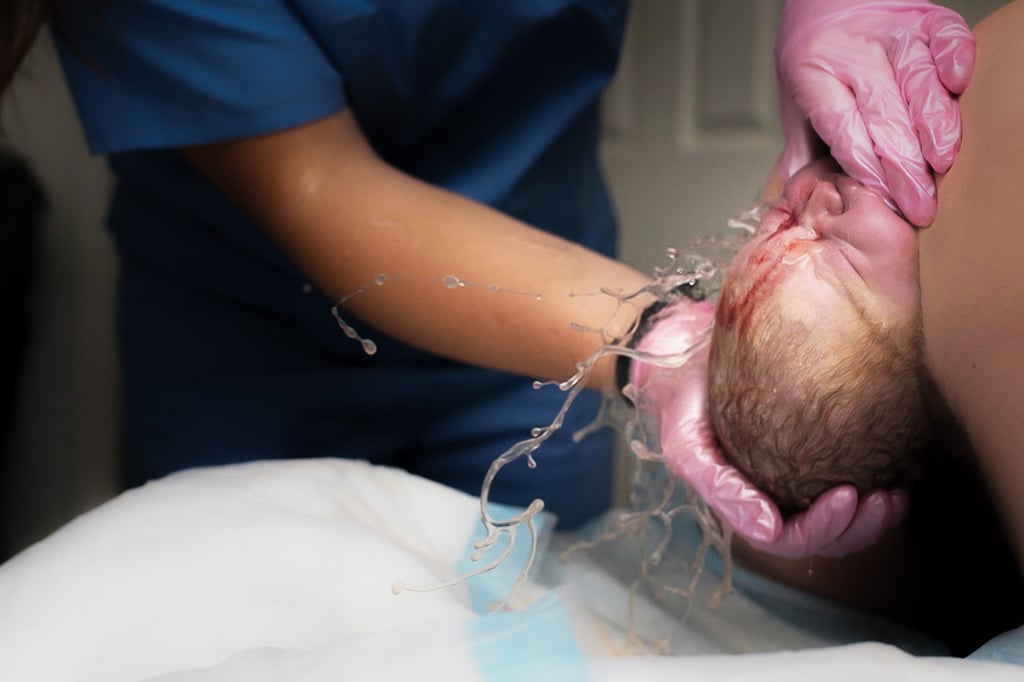 "I love capturing crowning shots. Some birth photographers shy away from sharing them, but I think they are so powerful and truly illustrate how incredible the female body is! When this baby’s head was born, some of the amniotic fluid came out with it — truly incredible."