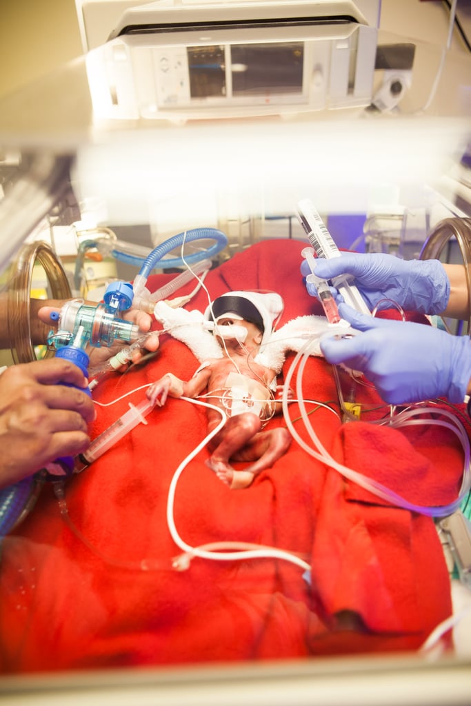 Photos of Baby Born Early at 23 Weeks