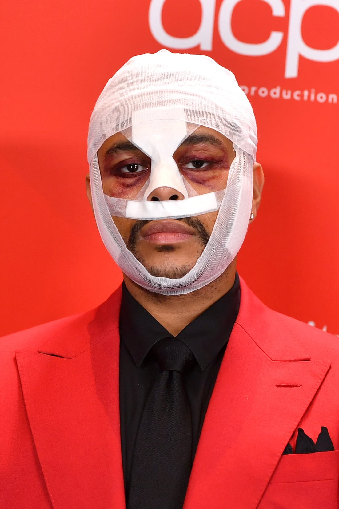 Why The Weeknd Has Bandages, Bloody Face At AMA