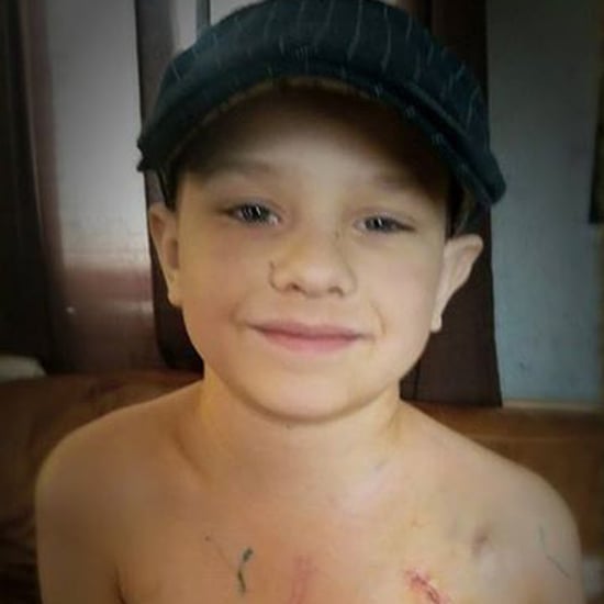 Boy's Heart Surgery Scars Shared on Facebook