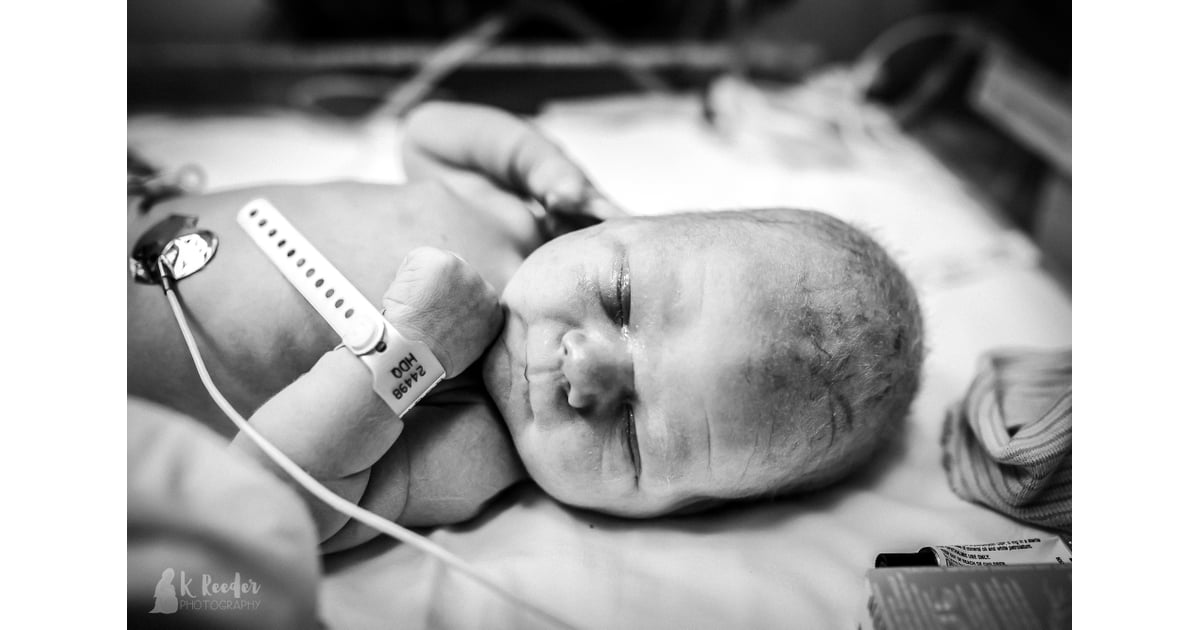 Newborn Head Molding During Birth POPSUGAR Family Photo 6