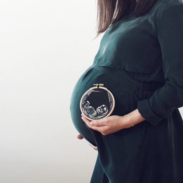 Embroidered Ultrasound Photo