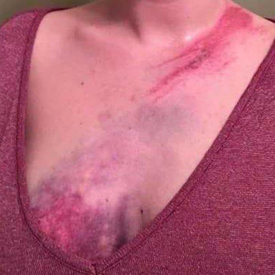 Mom's Warning About Rear-Facing Car Seats