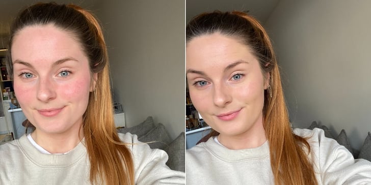 Rosalique Anti-Redness Formula Before and After Beauty UK