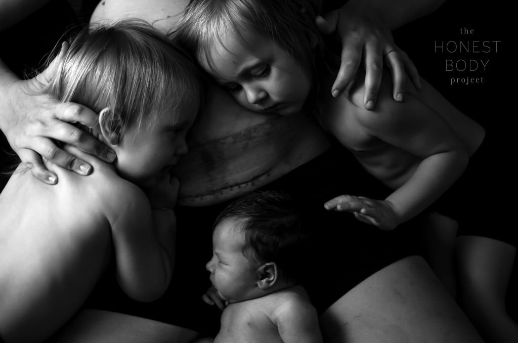 Honest Body Project Stapled C-Section Scar Photo Shoot