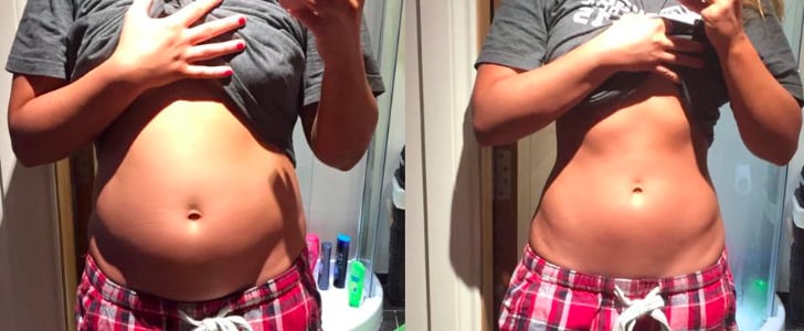 Blogger's Food Baby Disappears Overnight