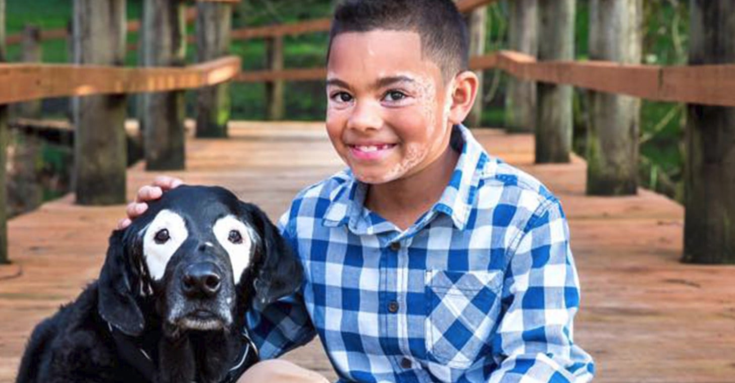 Boy With Vitiligo Meets Dog With Same Condition (Video) | POPSUGAR Family