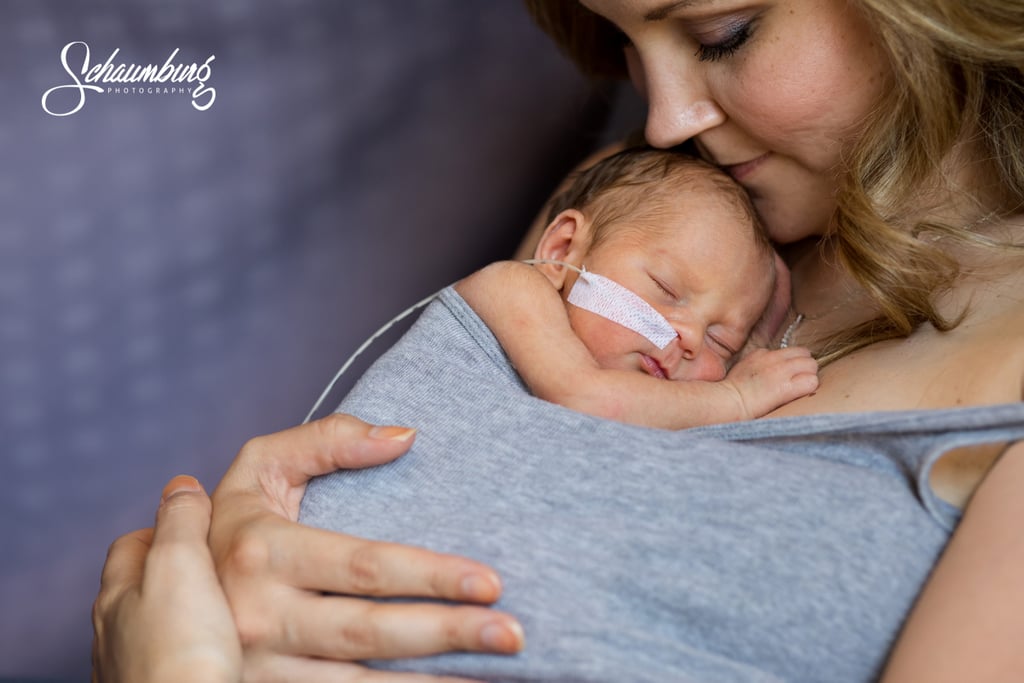 Moms Skin-to-Skin Bonding With Their Newborns in the NICU