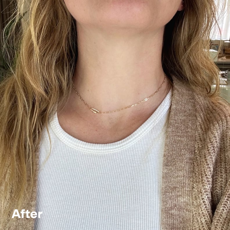 Experimento do editor de botox pescoço