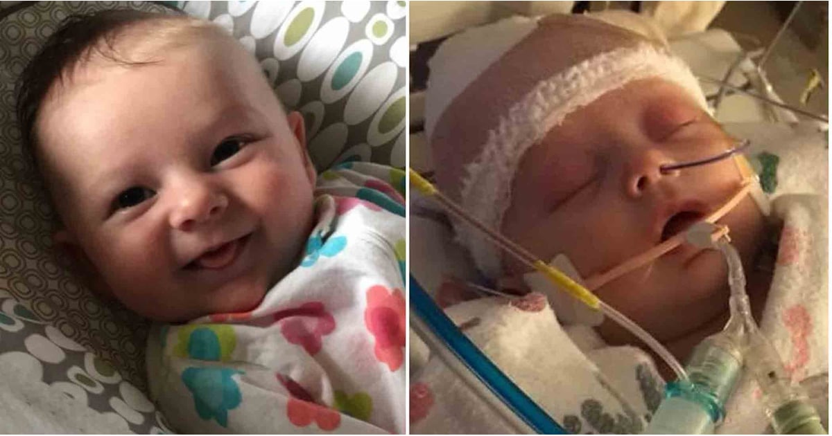 Baby Gets Hit In The Head With A Softball POPSUGAR Moms