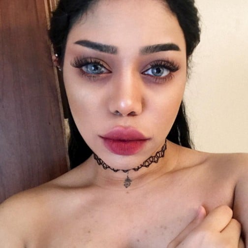 Beauty Vlogger Sonia Leslie's Eye Birthmark