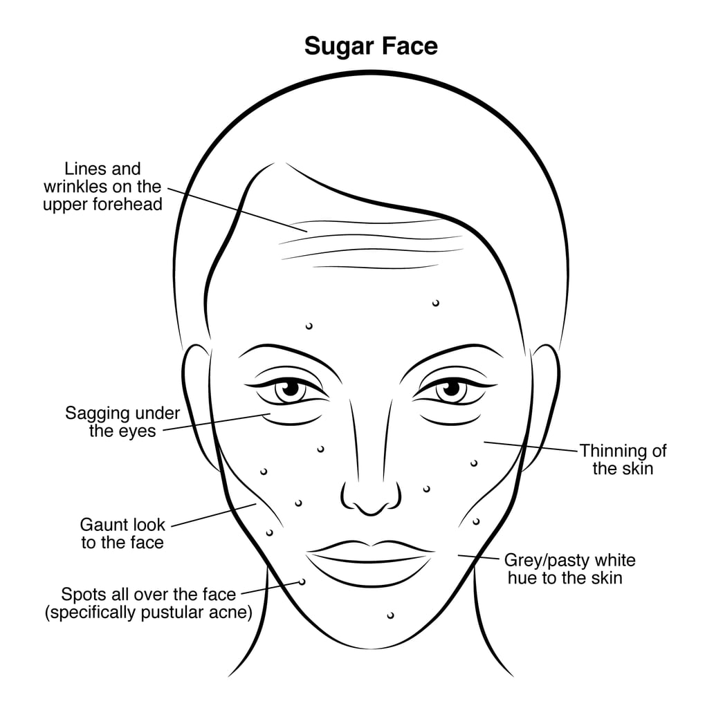 Sugar Face Gut Health And Skin Problems POPSUGAR Beauty Photo 4 sugar-face-gut-health-and-skin-problems-popsugar-beauty-photo-4