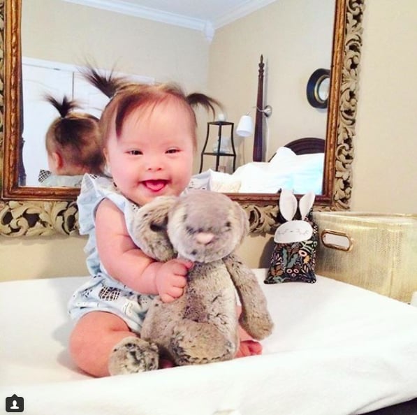 Photos of Babies With Down Syndrome
