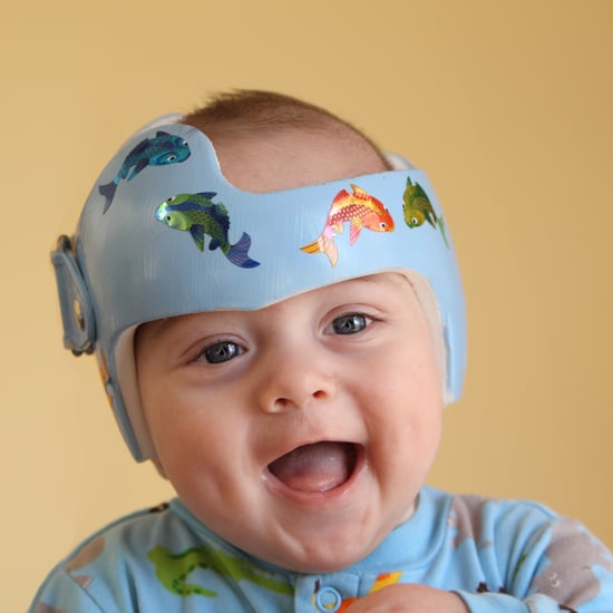 Are Baby Helmets a Cure For Flat Heads, or Unnecessary?