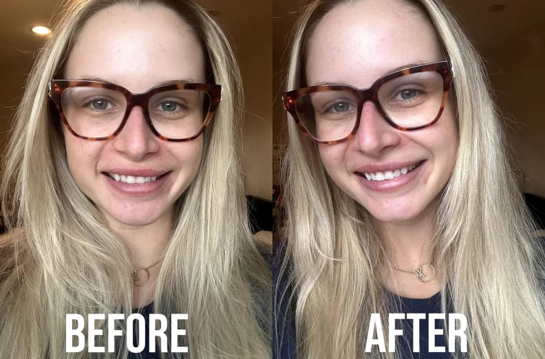 Best Beauty Deal on Teeth Whitening Strips