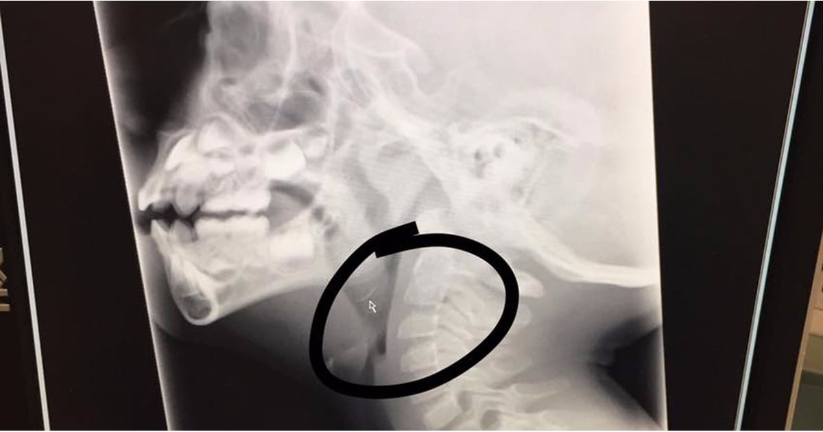 Why Metal Grill Brushes Are Dangerous POPSUGAR Moms