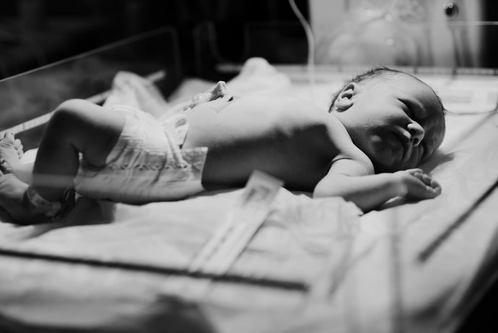 Dramatic C-Section Birth Photos