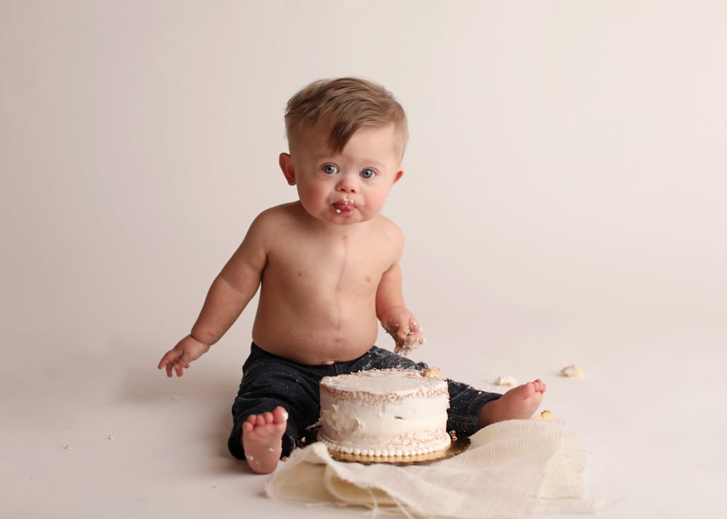 Baby With Down Syndrome Celebrates Birthday With Cake Smash