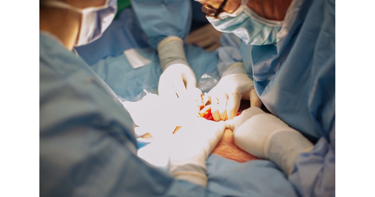 CSection Birth Photos POPSUGAR Family Photo 3