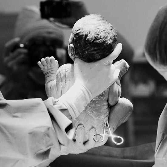 Dramatic C-Section Birth Photos
