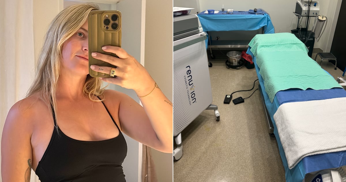 I Got the AirSculpt “Up a Cup” Breast Lift — Here Are My Unfiltered Thoughts
