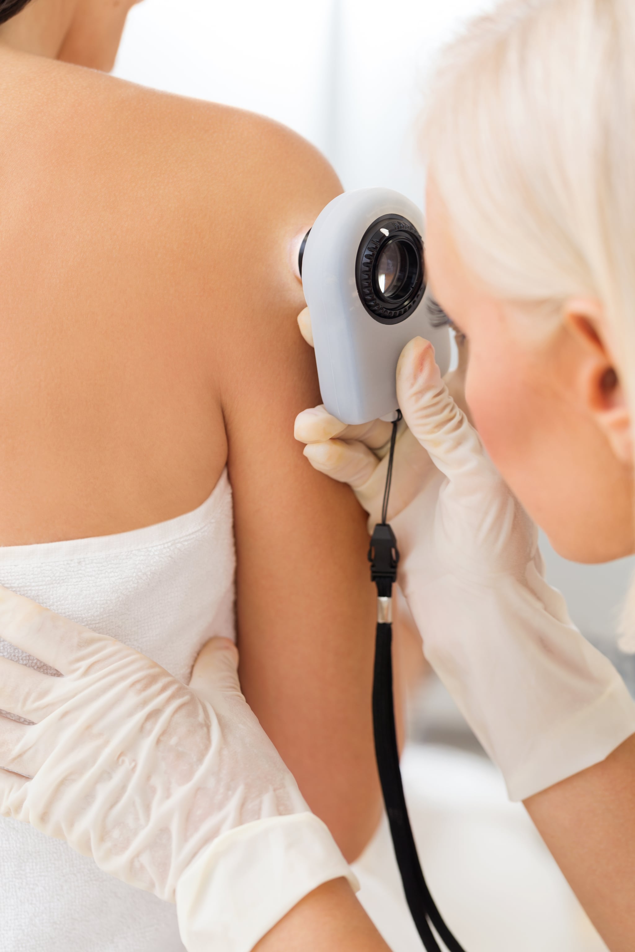 Female dermatologist examining female patient's skin with dermascope, doctor is carefully looking for signs of skin cancer