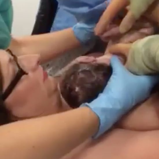 Baby Delivers Itself During C-Section Birth