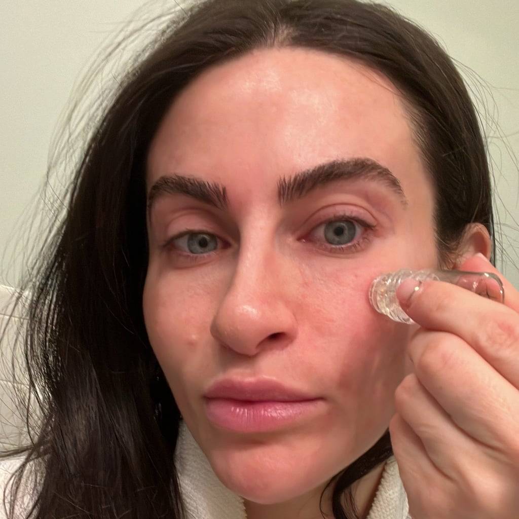 This Microneedling Alternative Is My Secret to Glowing Skin