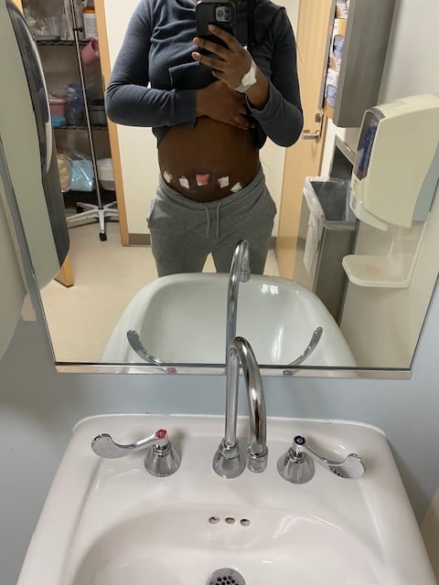 Rainelle Walker White post-surgery image