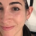 I Tried a Jet Peel Facial and Had My Skin Irrigated and My Blackheads Vacuumed Out
