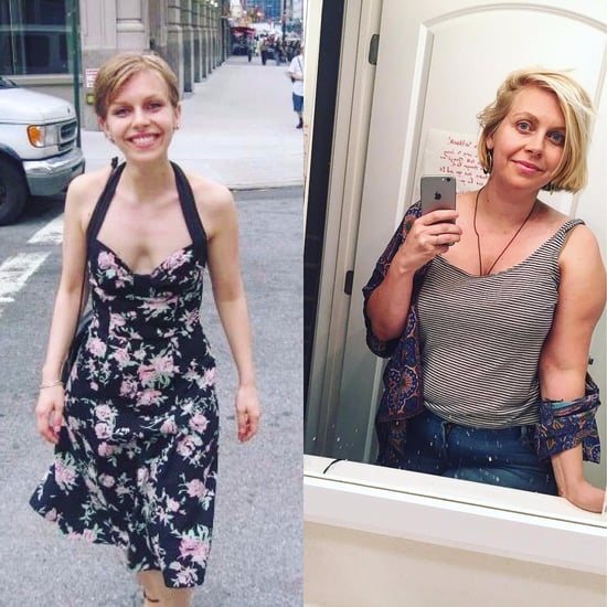 Mom's Photos Show How Birth Changed Her Body Image