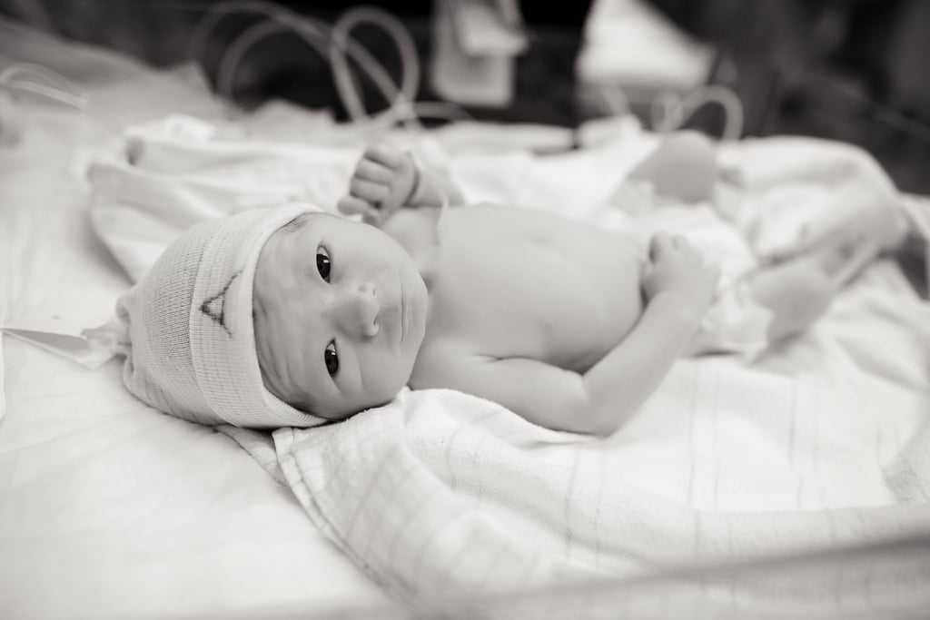 Photographs of Twin Birth