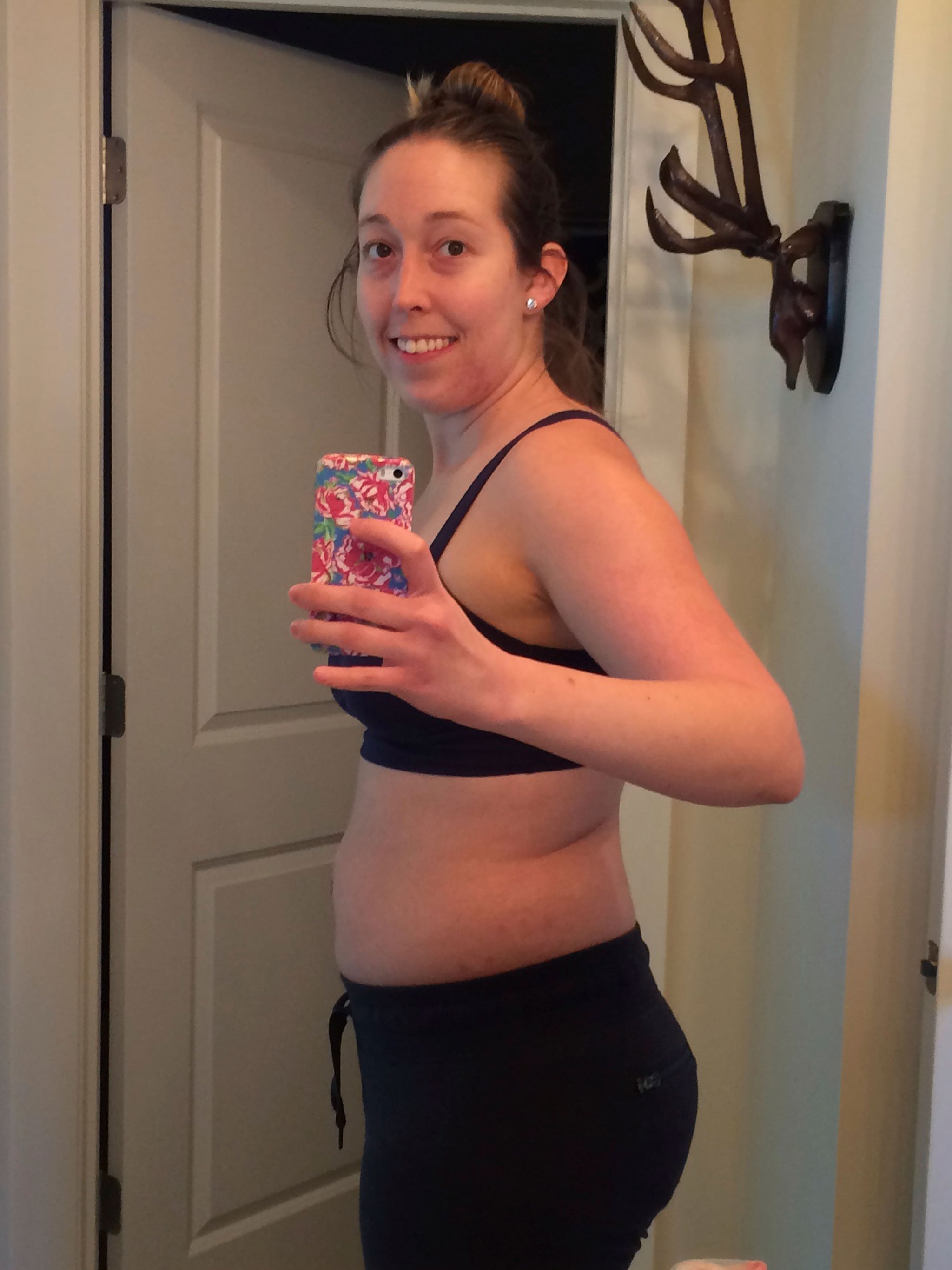 Weight Loss Surgery Before and After Photos - Health Travel Guide before and after weight loss surgery pictures
