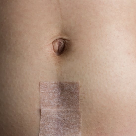What Not to Say to Someone Who Had a C-Section