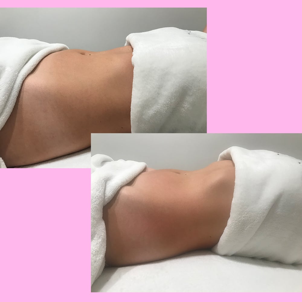 Venustus High Definition Bodywork Treatment Review Popsugar