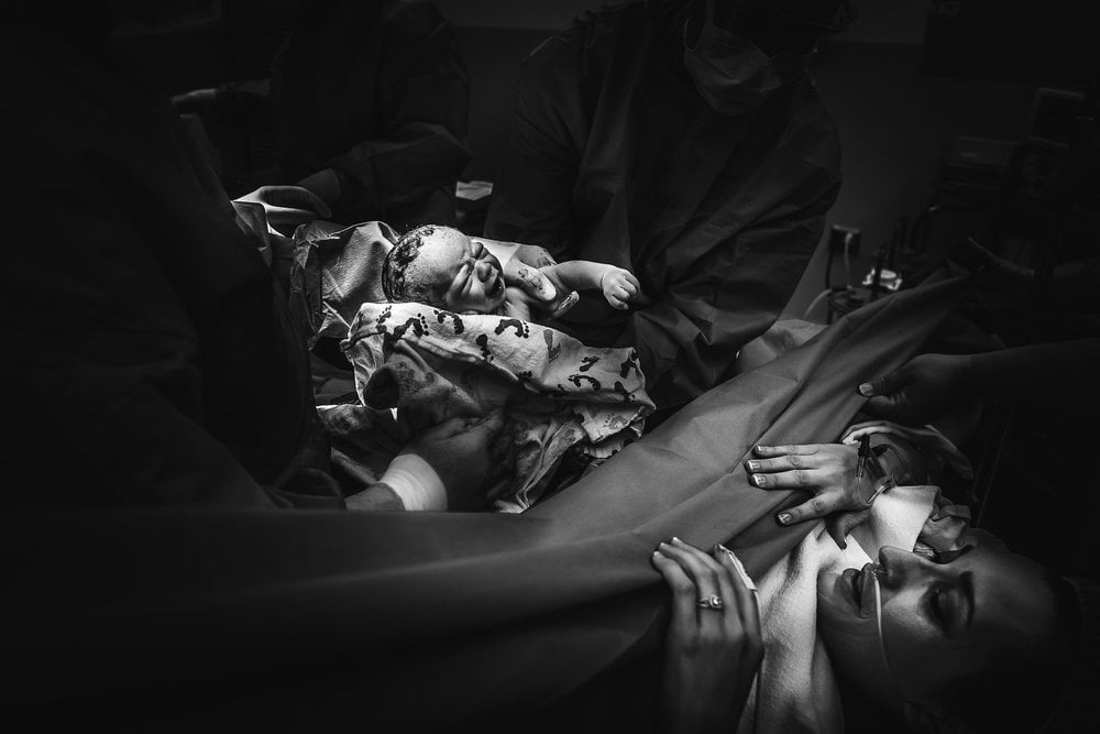 C-Section Birth Photography
