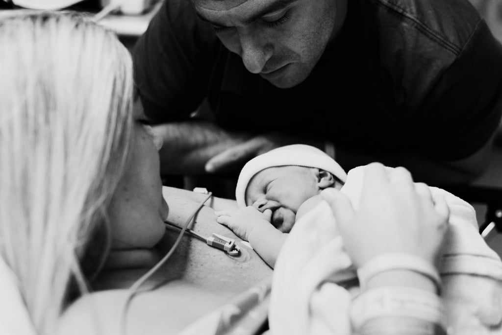 Dramatic C-Section Birth Photos