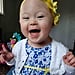 Toddler With Down Syndrome Beats Cancer Twice