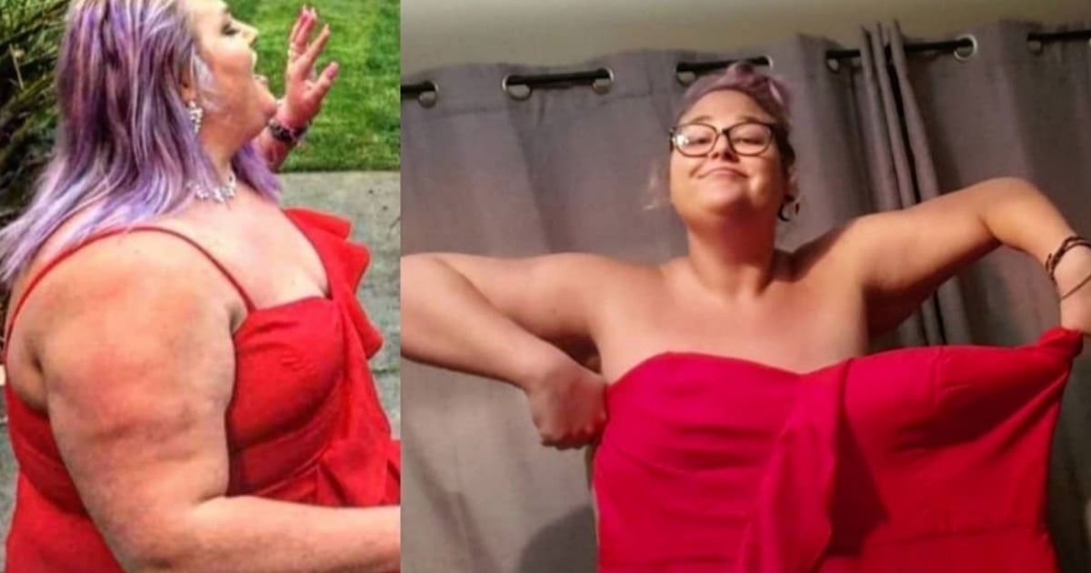 WeightLoss Transformation Binge Eating and Bulimia Recovery POPSUGAR